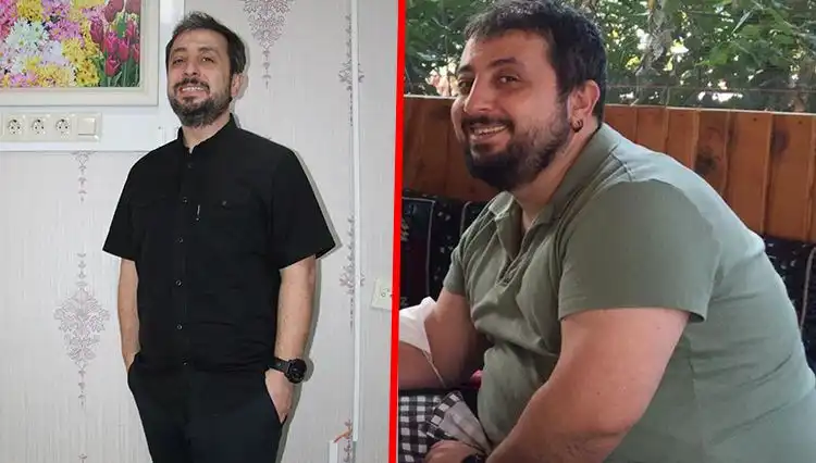 İki Yılda 40 Kilo Verdi: Mide Küçültme Ameliyatı Hakkında Merak Edilenler