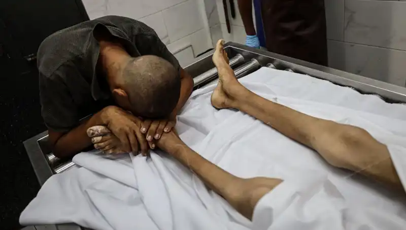 Gazze'de Acı: Bir Çocuk Daha Açlıktan Hayata Veda Etti